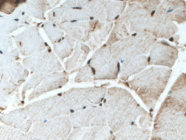 SMCHD1 Antibody in Immunohistochemistry (Paraffin) (IHC (P))