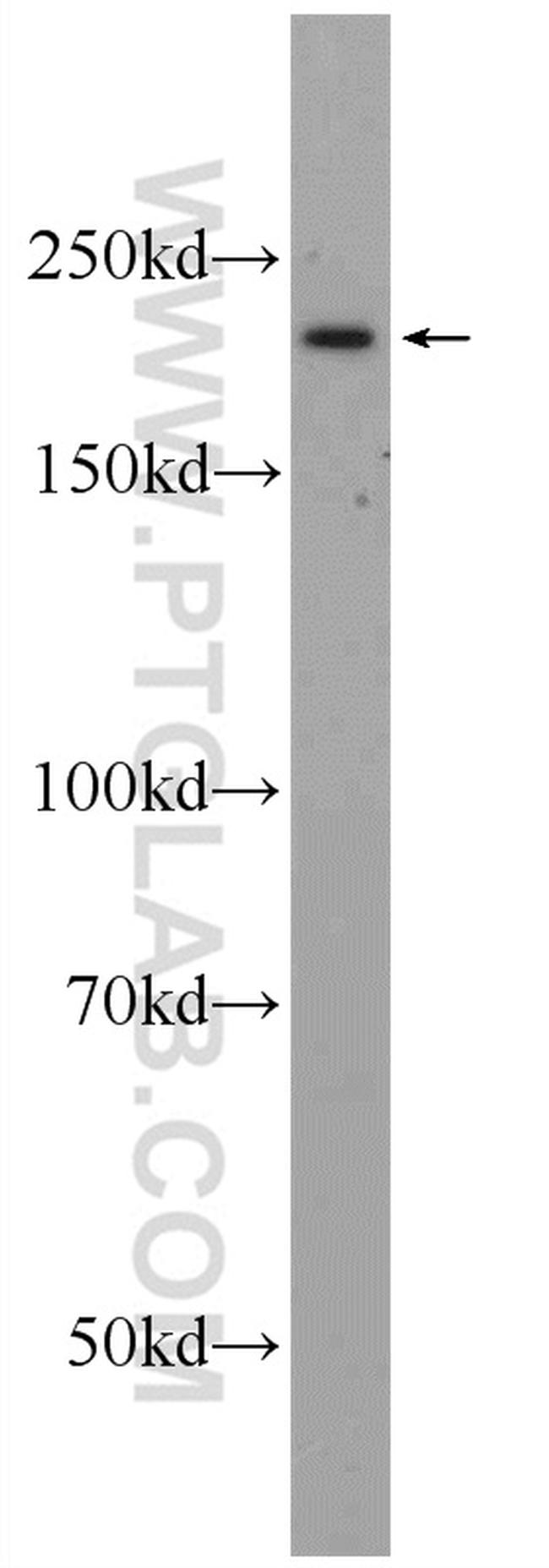 SMCHD1 Antibody in Western Blot (WB)