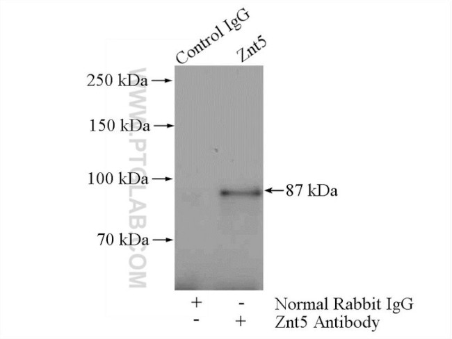 Znt5 Antibody in Immunoprecipitation (IP)