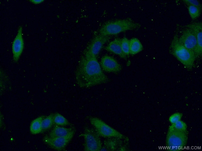 EPHX3 Antibody in Immunocytochemistry (ICC/IF)