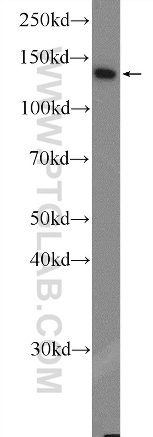 CEBPZ Antibody in Western Blot (WB)