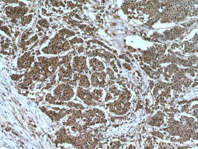 P27/KIP1 Antibody in Immunohistochemistry (Paraffin) (IHC (P))