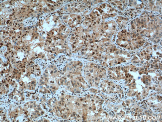 P27/KIP1 Antibody in Immunohistochemistry (Paraffin) (IHC (P))