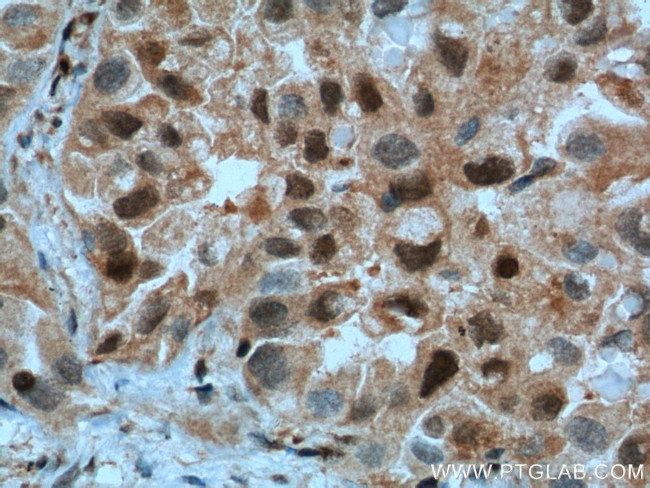 P27/KIP1 Antibody in Immunohistochemistry (Paraffin) (IHC (P))