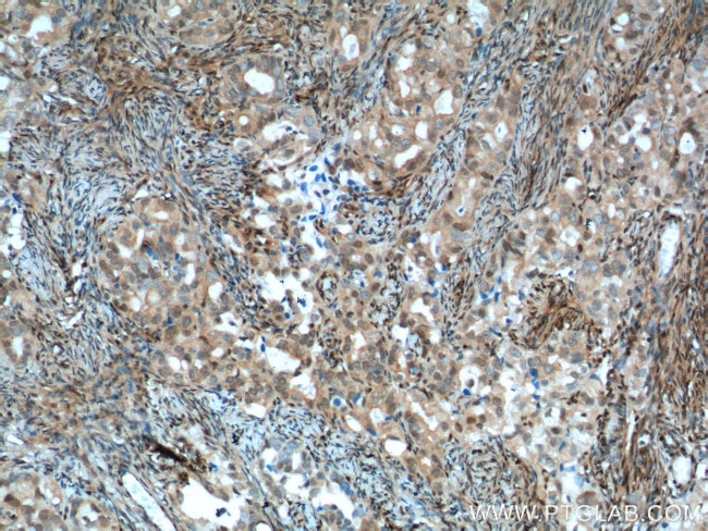 P27/KIP1 Antibody in Immunohistochemistry (Paraffin) (IHC (P))