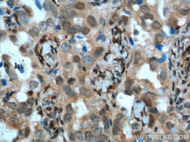 P27/KIP1 Antibody in Immunohistochemistry (Paraffin) (IHC (P))