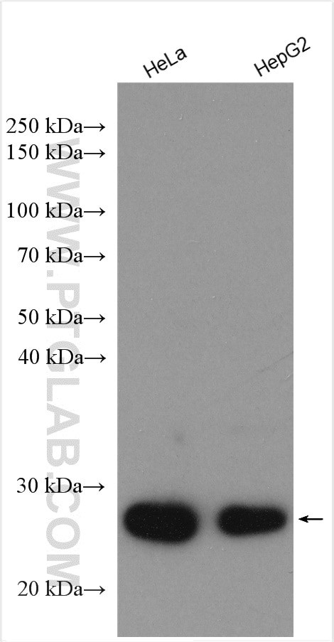 P27/KIP1 Antibody in Western Blot (WB)