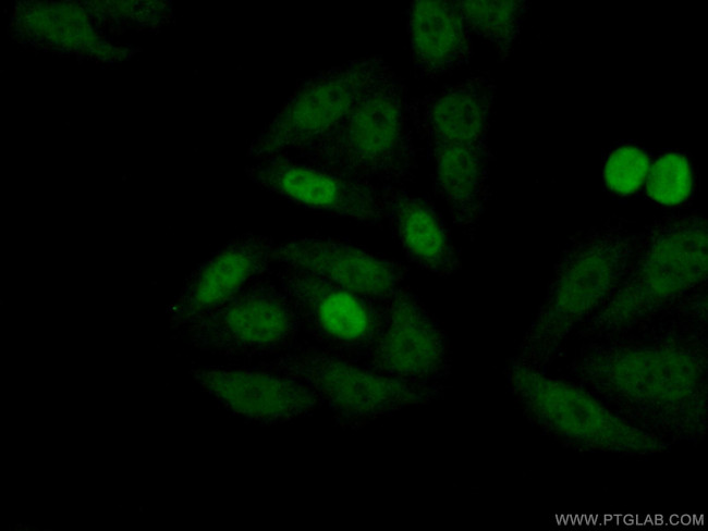 P27/KIP1 Antibody in Immunocytochemistry (ICC/IF)