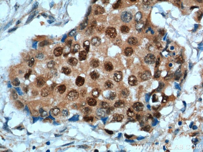 P27/KIP1 Antibody in Immunohistochemistry (Paraffin) (IHC (P))