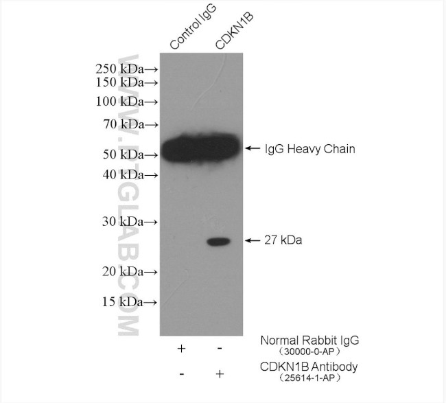 P27/KIP1 Antibody in Immunoprecipitation (IP)