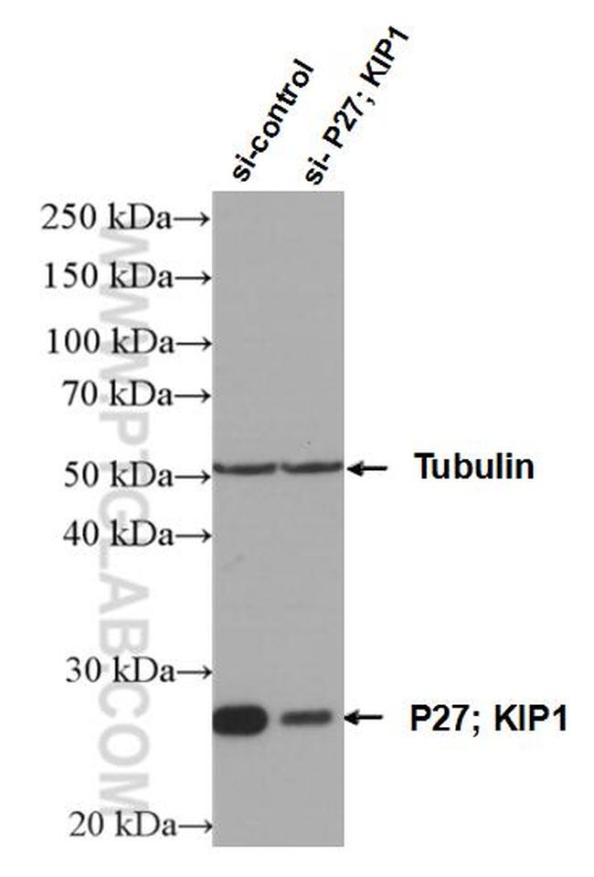 P27/KIP1 Antibody in Western Blot (WB)