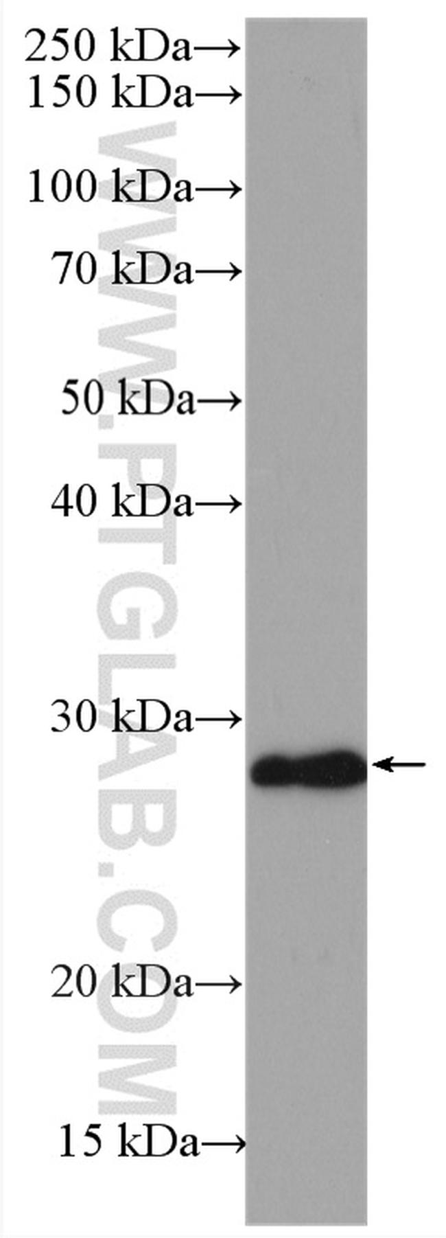 P27/KIP1 Antibody in Western Blot (WB)