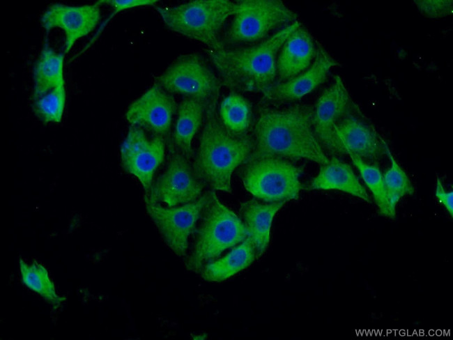 BHLHE22 Antibody in Immunocytochemistry (ICC/IF)