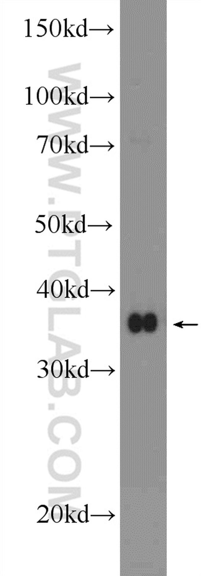 BHLHE22 Antibody in Western Blot (WB)