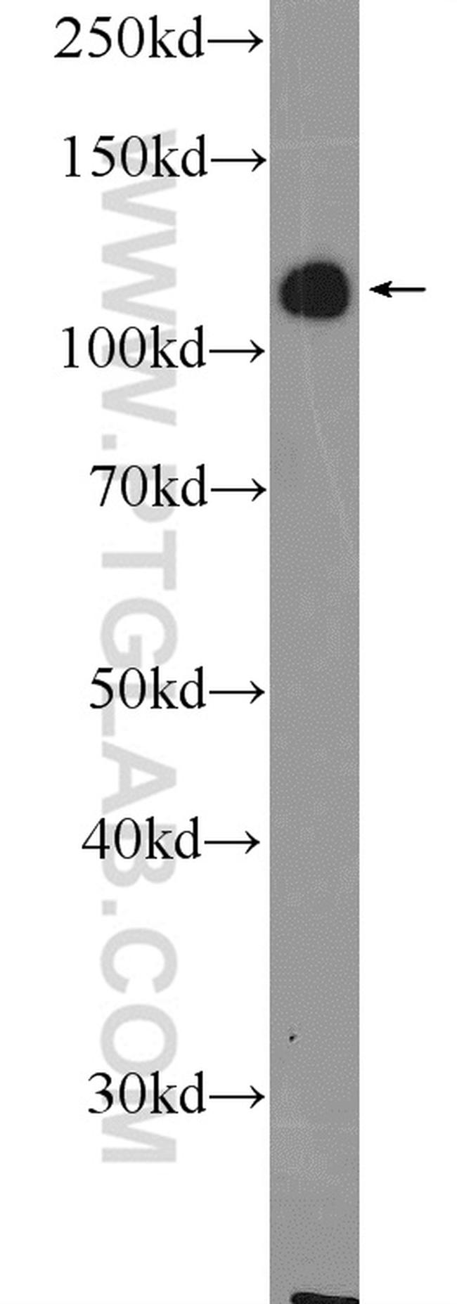 ZC3H7B Antibody in Western Blot (WB)