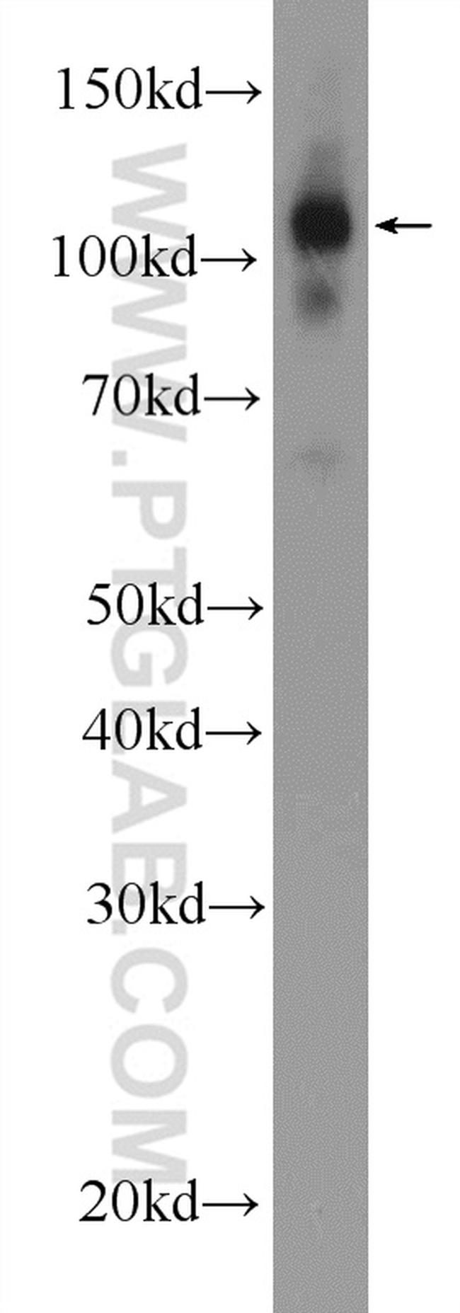 ZC3H7B Antibody in Western Blot (WB)