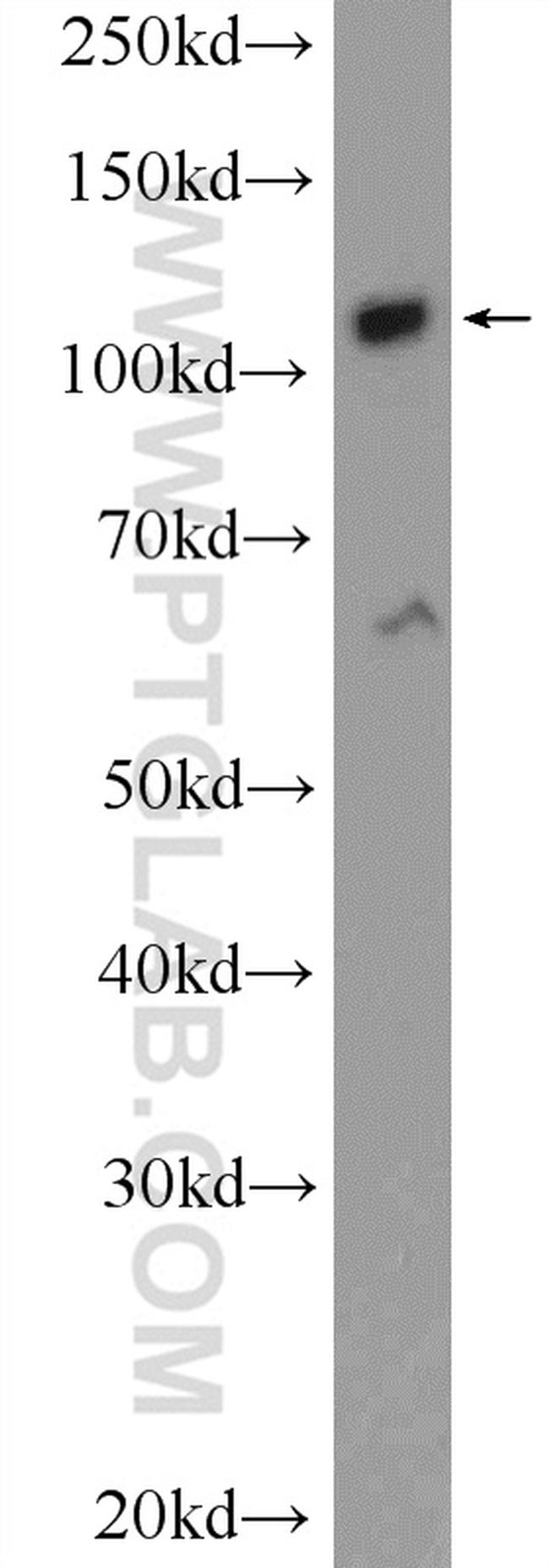 ZC3H7B Antibody in Western Blot (WB)