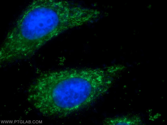 CHCHD3 Antibody in Immunocytochemistry (ICC/IF)