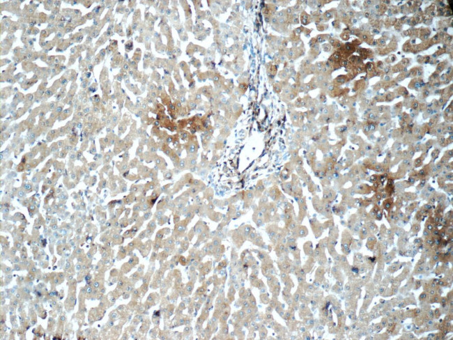 CHCHD3 Antibody in Immunohistochemistry (Paraffin) (IHC (P))