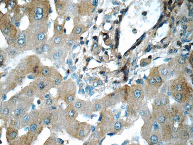 CHCHD3 Antibody in Immunohistochemistry (Paraffin) (IHC (P))