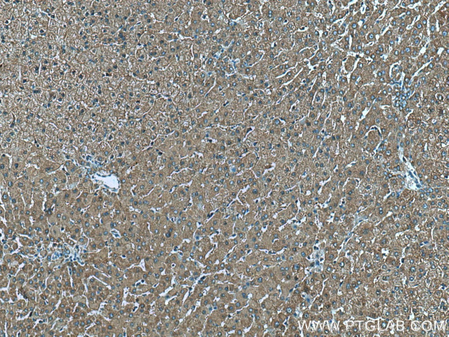 CHCHD3 Antibody in Immunohistochemistry (Paraffin) (IHC (P))