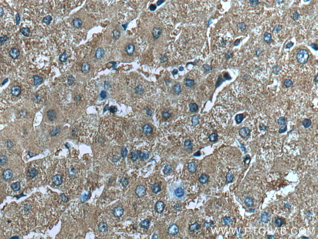 CHCHD3 Antibody in Immunohistochemistry (Paraffin) (IHC (P))