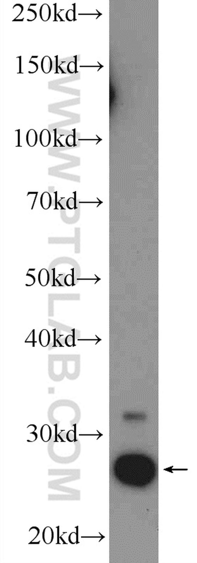 CHCHD3 Antibody in Western Blot (WB)