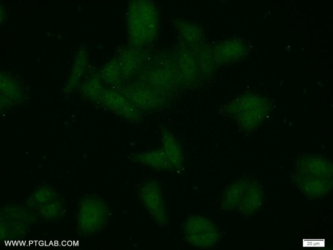 ZCRB1 Antibody in Immunocytochemistry (ICC/IF)