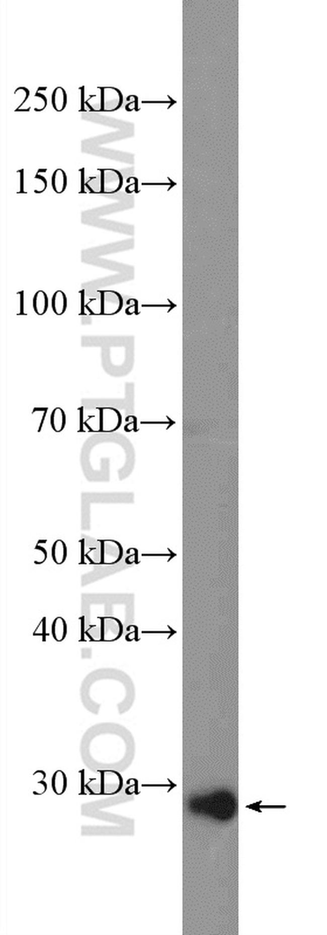 ZCRB1 Antibody in Western Blot (WB)