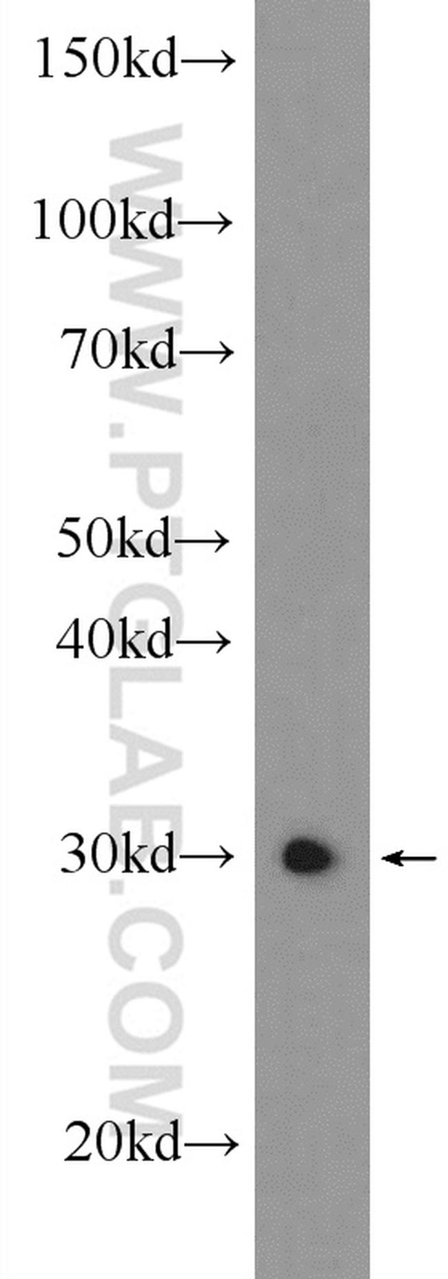 ZCRB1 Antibody in Western Blot (WB)