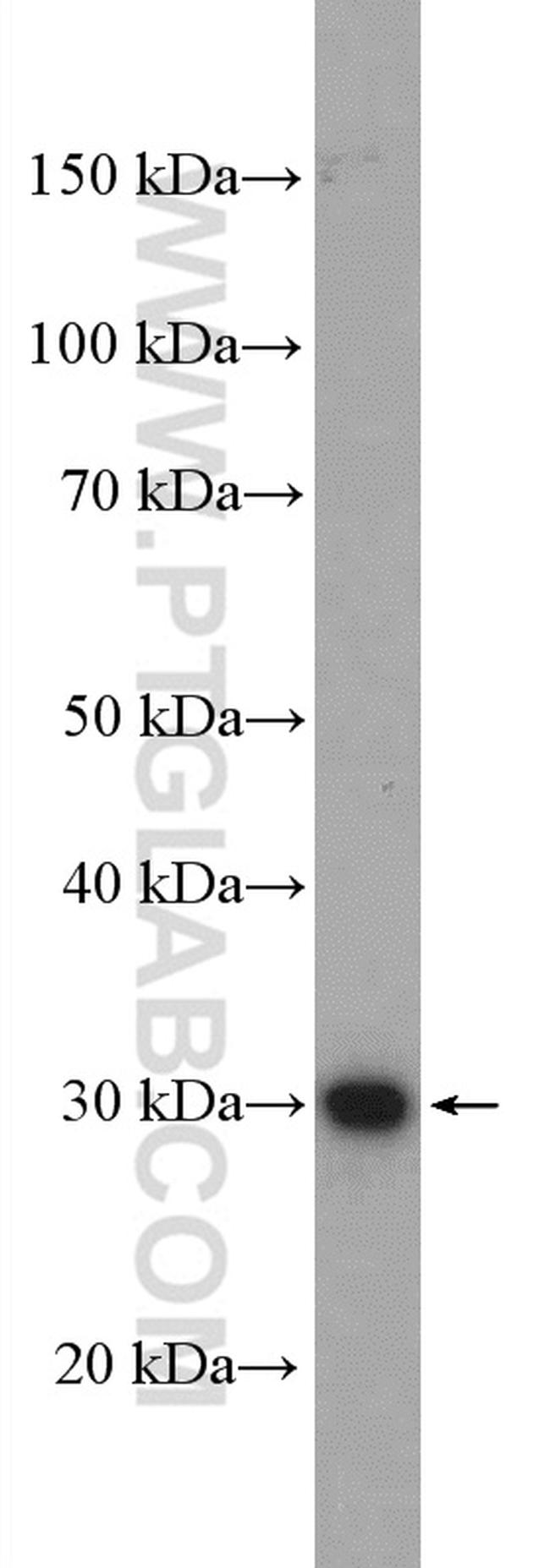 ZCRB1 Antibody in Western Blot (WB)