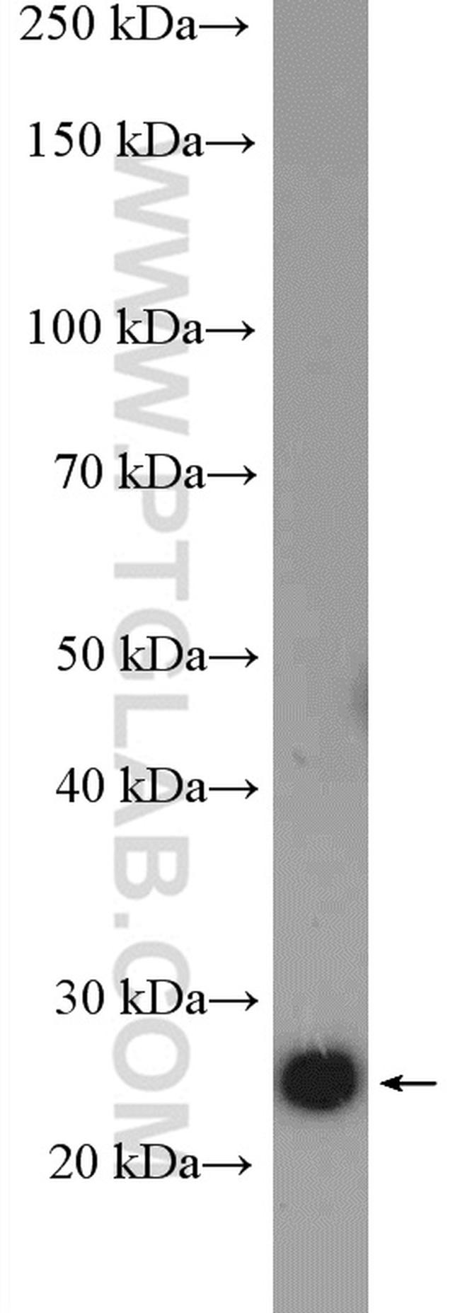 ZCRB1 Antibody in Western Blot (WB)