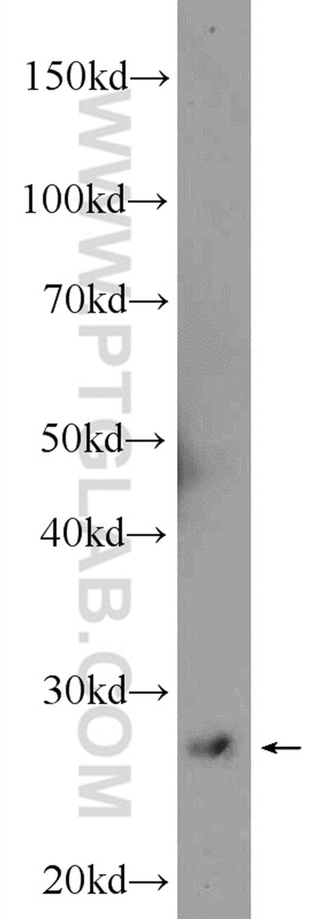 ZCRB1 Antibody in Western Blot (WB)