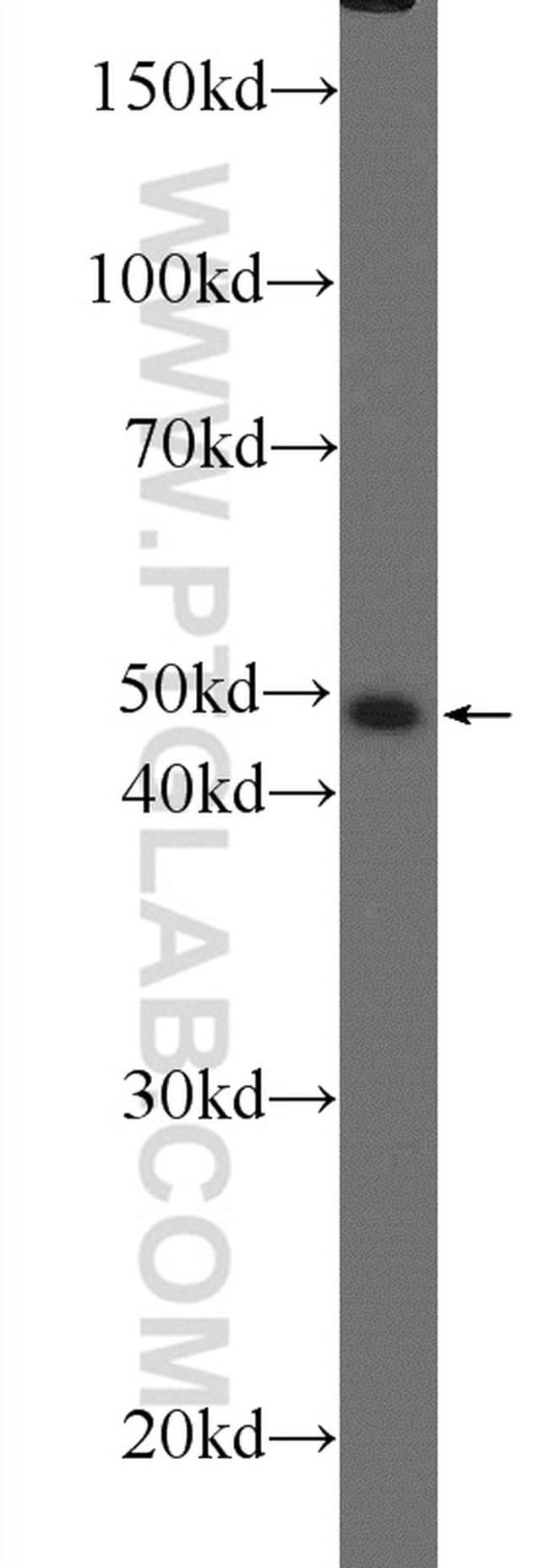 ZBTB25 Antibody in Western Blot (WB)