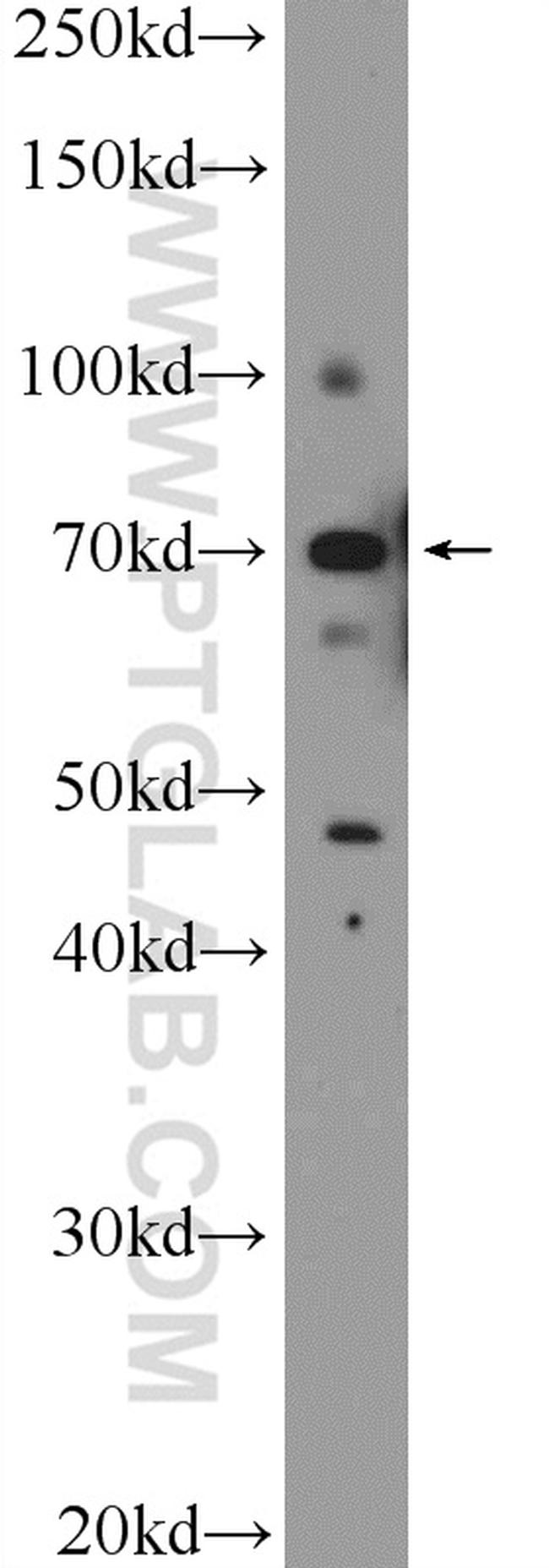 ZBTB22 Antibody in Western Blot (WB)