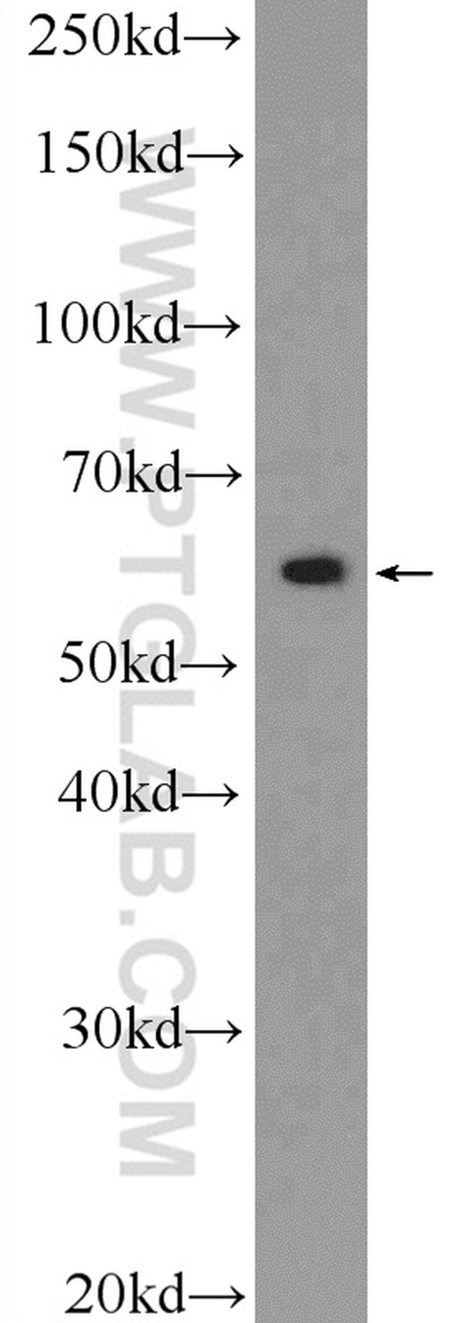 ZBTB22 Antibody in Western Blot (WB)