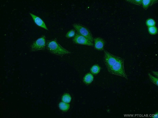 VNN2 Antibody in Immunocytochemistry (ICC/IF)