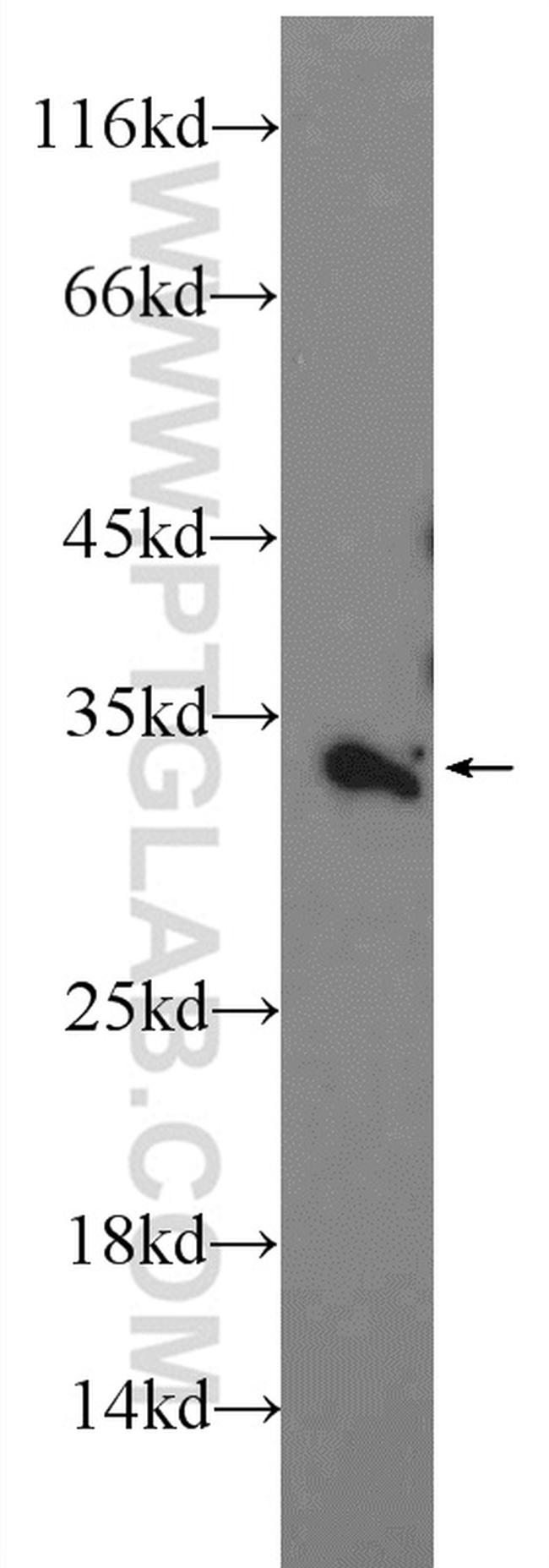 VNN2 Antibody in Western Blot (WB)