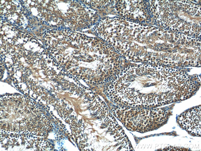 C19orf36 Antibody in Immunohistochemistry (Paraffin) (IHC (P))