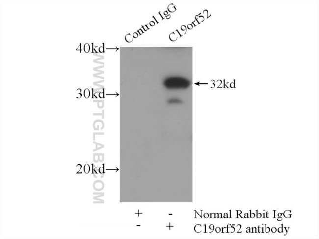 C19orf52 Antibody in Immunoprecipitation (IP)