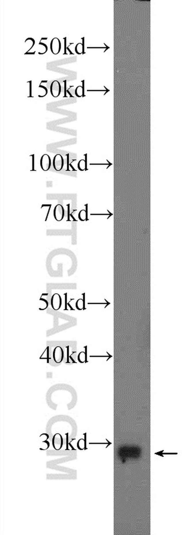 C19orf52 Antibody in Western Blot (WB)