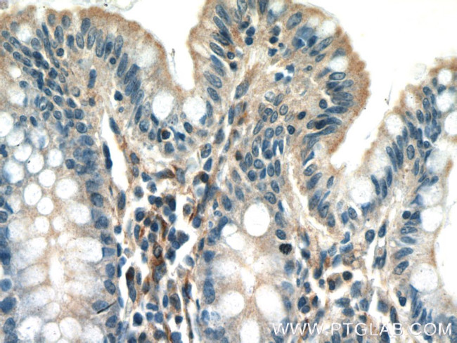 UACA Antibody in Immunohistochemistry (Paraffin) (IHC (P))