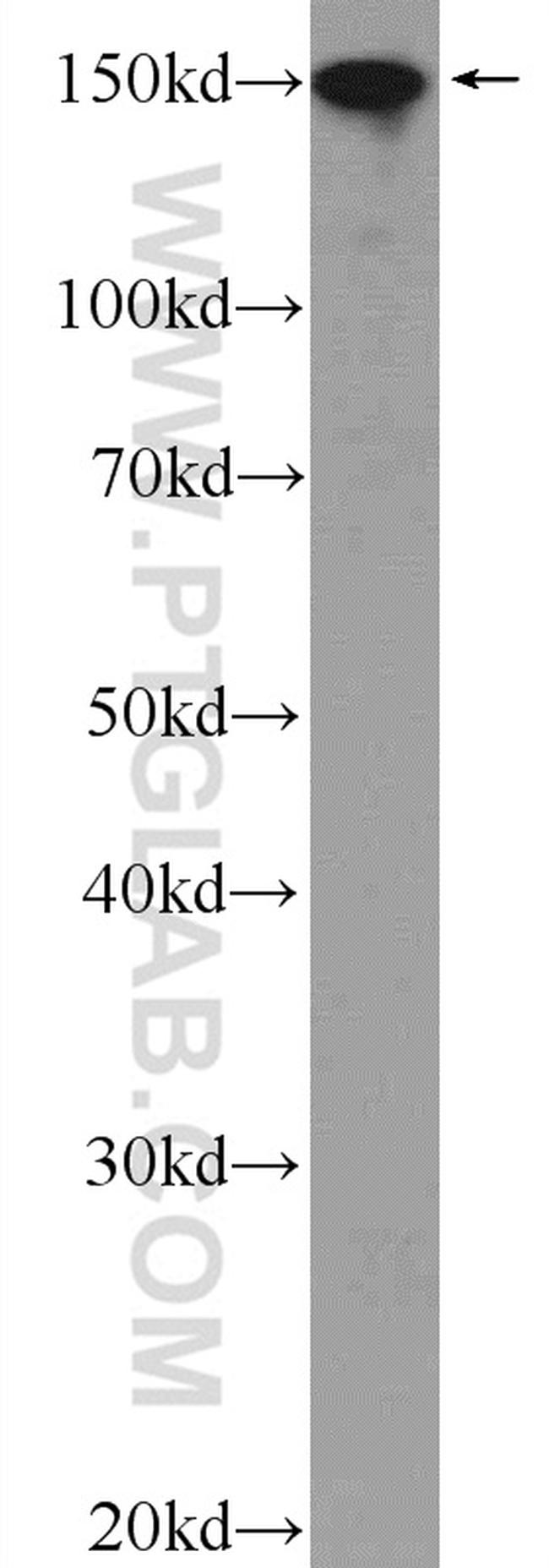 UACA Antibody in Western Blot (WB)