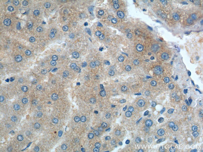 DENND1A Antibody in Immunohistochemistry (Paraffin) (IHC (P))