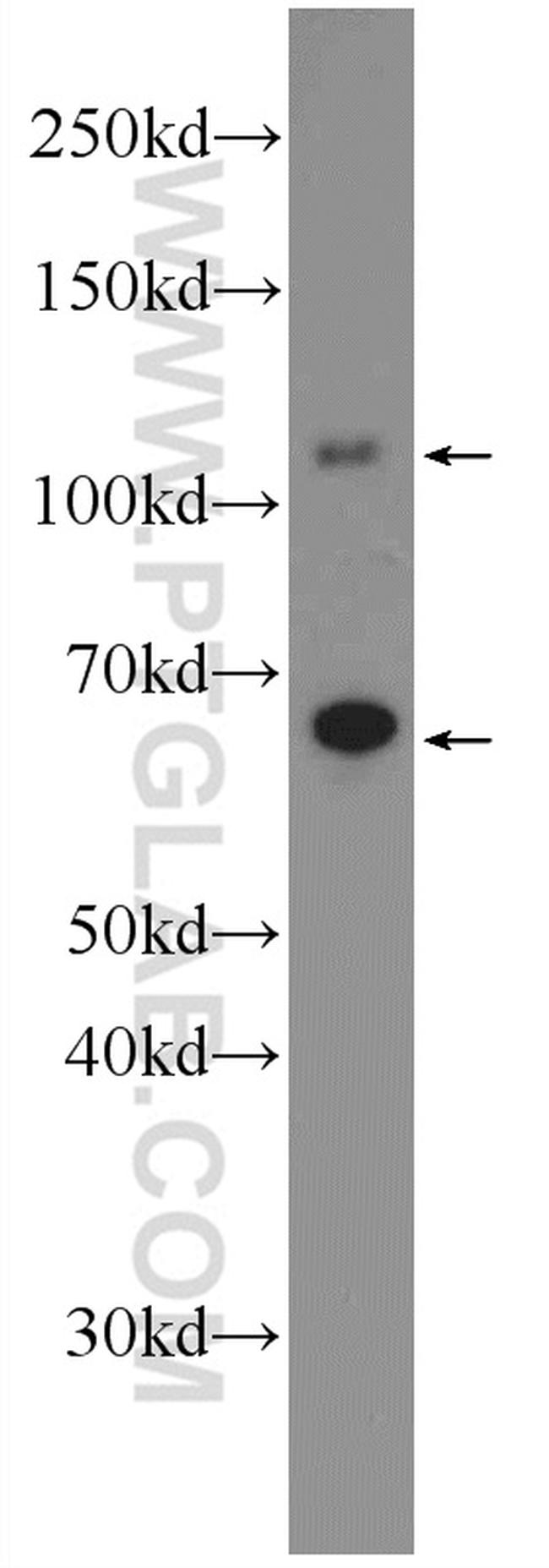 DENND1A Antibody in Western Blot (WB)