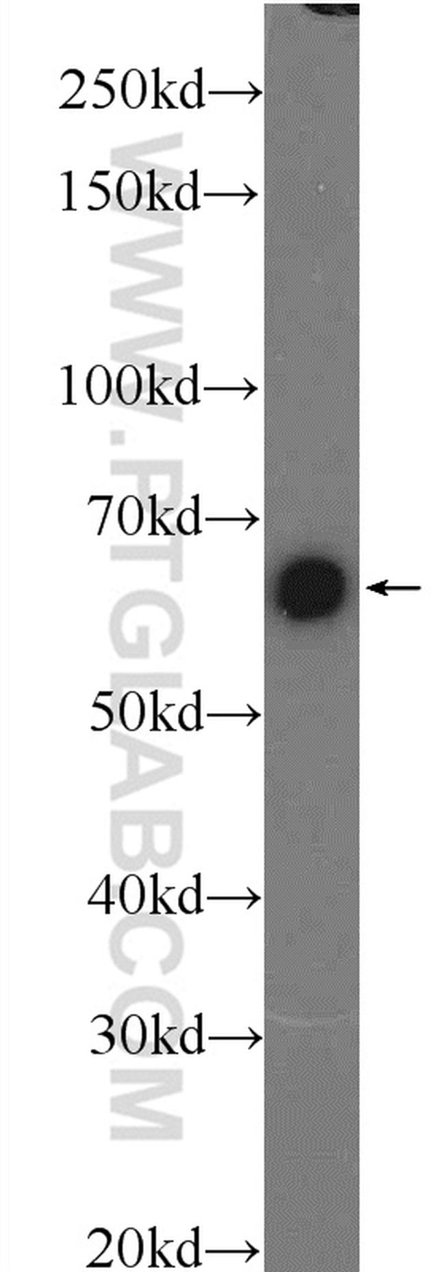 PKM Antibody in Western Blot (WB)