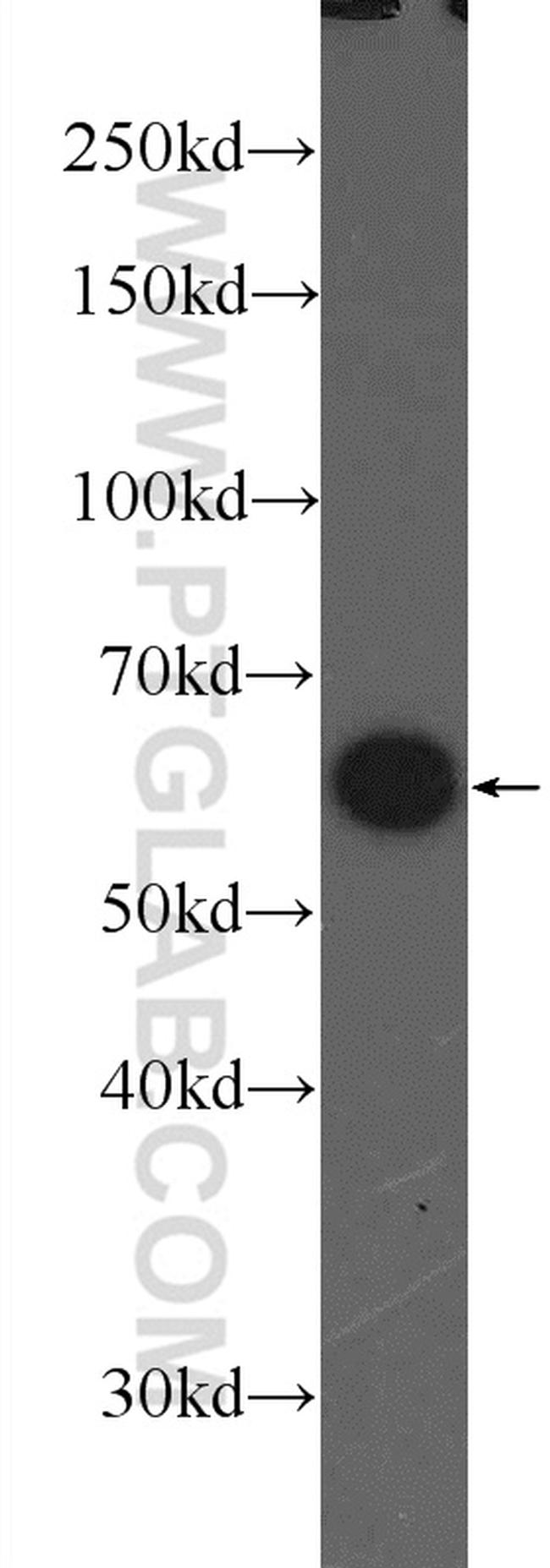 PKM Antibody in Western Blot (WB)