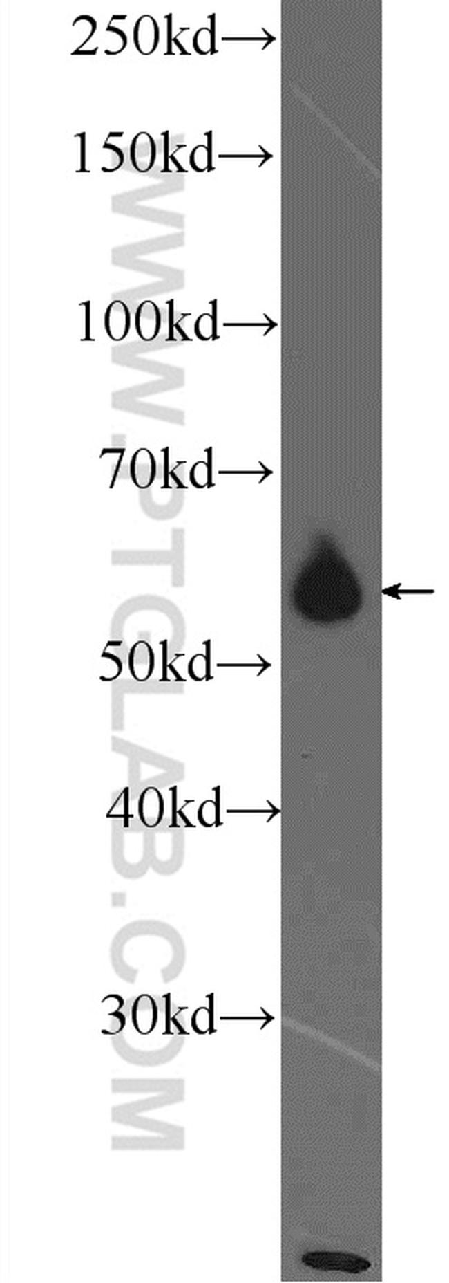 PKM Antibody in Western Blot (WB)