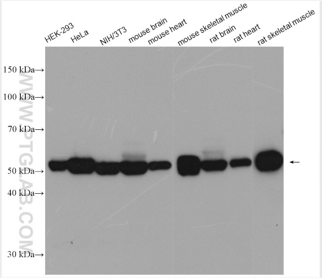 PKM Antibody in Western Blot (WB)