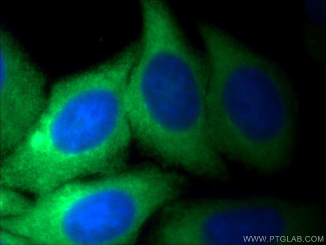 PKM Antibody in Immunocytochemistry (ICC/IF)